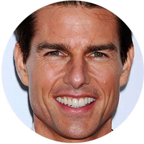 San Diego Smile Dentistry Celebrity Teeth Before And After