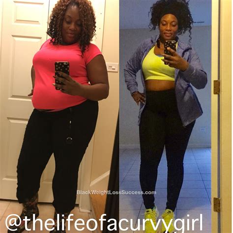 Pin On Before And After Weight Loss Stories