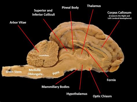 Sagittal Section Of Sheep Brain Part 3 Diagram Quizle