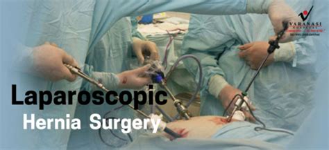 Tips For A Speedy Recovery After A Laparoscopic Hernia Operation