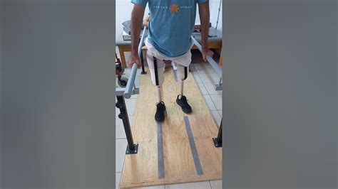 Transfemoral Bilateral Amputee Gait Shorts Prosthesis