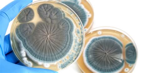Weekly Dose Penicillin The Mould That Saves Millions Of Lives