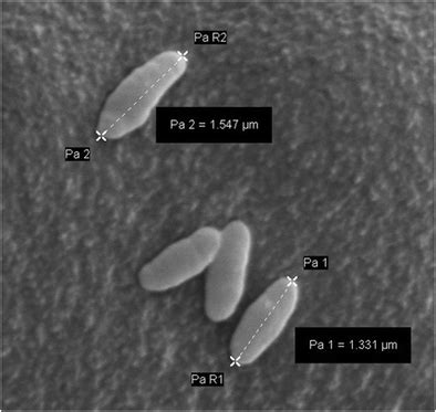 Electron Micrograph Of Photobacterium Sp Strain J15 Isolated From