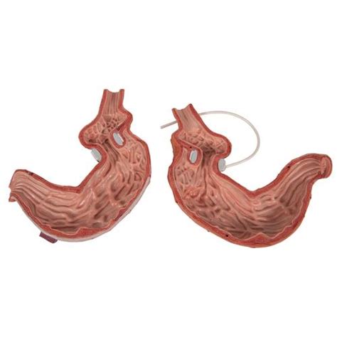 Human Stomach Model With Gastric Band 2 Part 3b Smart Anatomy K15