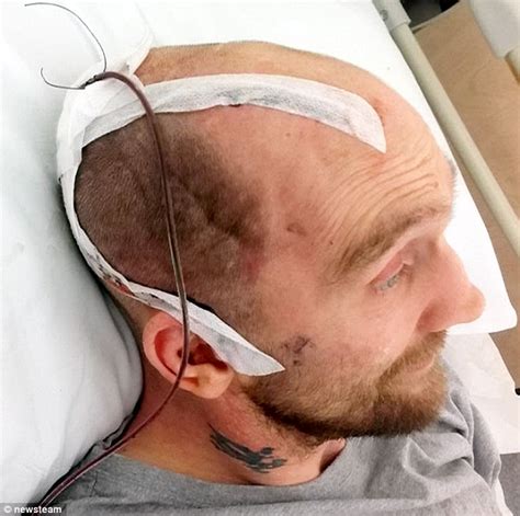 Bouncer Who Caved In Mans Skull With A Punch Jailed For Just 16 Months