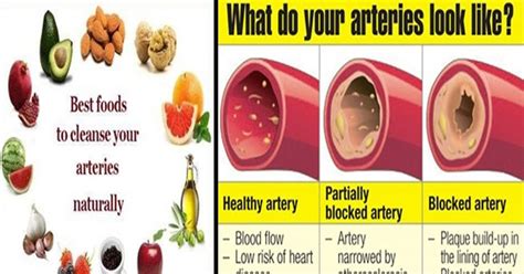 Maybe you would like to learn more about one of these? 18 Foods That Clear The Arteries And Prevent Heart Attack ...