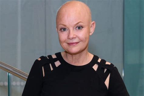 Gail Porter Admits She Quite Likes Being Bald Metro News