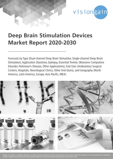 Deep Brain Stimulation Devices Market Size Industry Report 2020 2030
