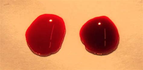 Blood oxygenation is associated with health and physical fitness 41, whereas deoxygenated blood is associated with ill health 16. Tiny beads can deliver oxygen straight to the blood stream ...