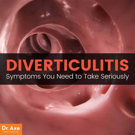 Diverticulitis Symptoms You Can Treat Naturally Best Pure Essential Oils