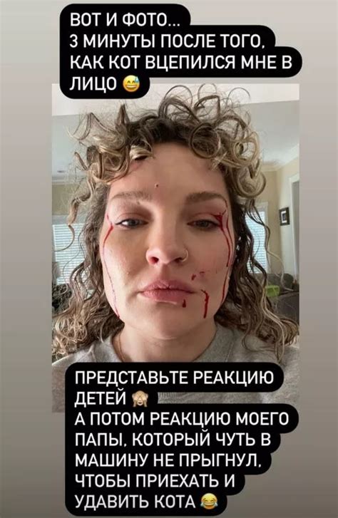Страшная ситуация Хоккеист Тихонов — о жутком фото жены с разодранным лицом Рамблерспорт