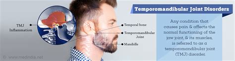 Health Tip On Temporomandibular Joint Tmj Disorders