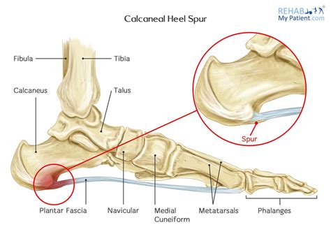 Anatomy Of The Calcaneus Anatomy Drawing Diagram Images And Photos Finder