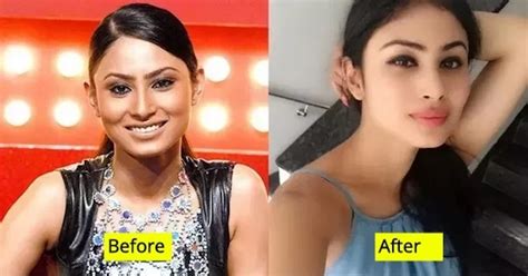 Then And Now Looks Of 10 Bollywood Actresses Who Have Undergone Plastic