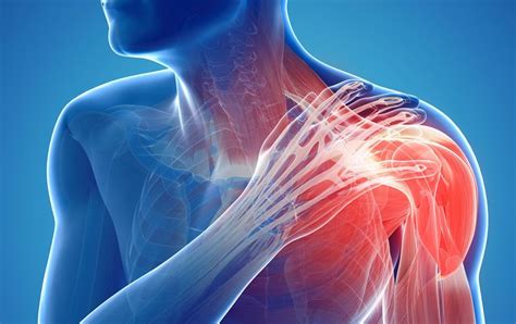 Shoulder Blade Pain Symptoms Causes Diagnosis And Treatment