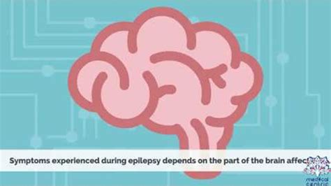 Epilepsy Causes Signs And Symptoms Diagnosis And Treatment Youtube