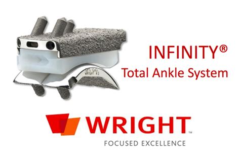 Wright Medical Launches Infinity Total Ankle Implant Massdevice