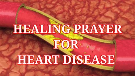 POWERFUL HEALING PRAYER FOR THOSE SUFFERING FROM HEART DISEASE - YouTube