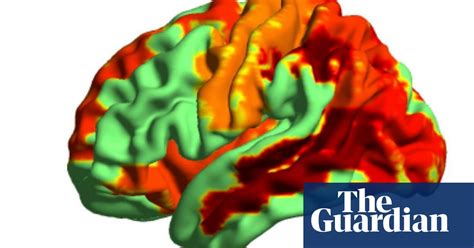 Psychedelic Drugs Induce Heightened State Of Consciousness Brain