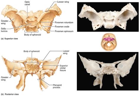 Keystone Bone Of Cranium