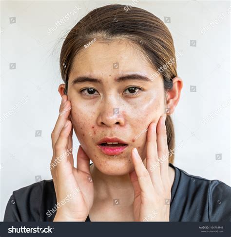 Portrait Asian Woman Having Problems Oily Stock Photo Shutterstock