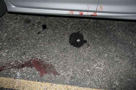 Graphic Crime Scene Photos Show Aftermath Of Gun Battle Outside Strip Club Involving Sapd Officer