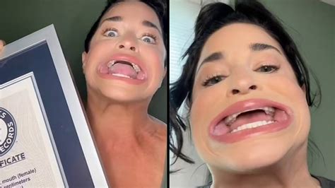 guinness world record holder for largest mouth gape has now broken a second one