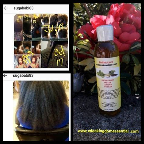 In fact, if done improperly, they can cause more harm than good. Formula D Hair ReGrowth Serum For CCCA- Baldspots-BigChop-Alopecia- Hair Growth Oil For All Hair ...