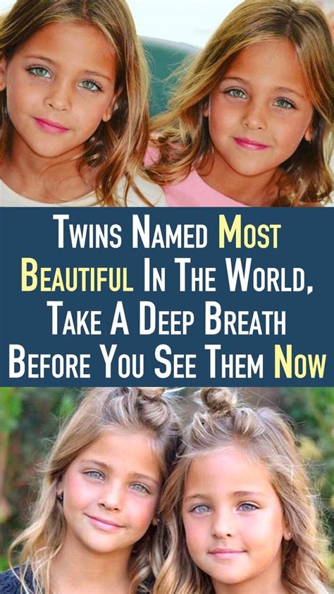 Twins Named Most Beautiful In The World Take A Deep Breath Before You