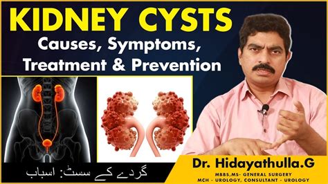 Simple Kidney Cysts Kidney Cyst Symptoms Renal Cyst Treatment Dr
