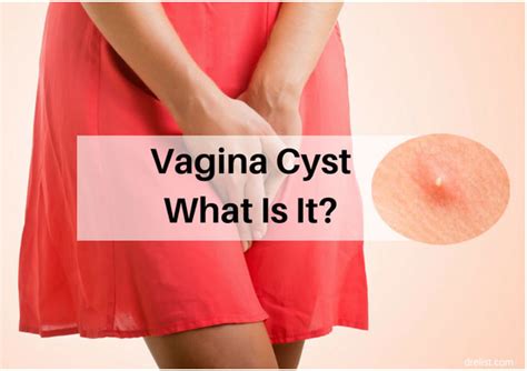 Causes And Symptoms Of Cyst Below Your Waist Do Not Ignore It Find