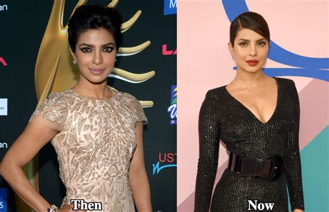 Priyanka Chopra Boob Job Before And After Latest Plastic Surgery