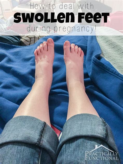 Dealing With Swollen Feet During Pregnancy Practically Functional