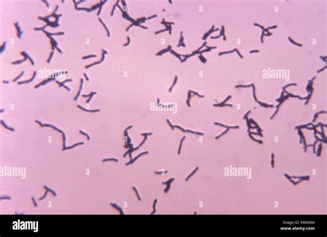 This Micrograph Depicts The Gram Positive Bacterium Bifidobacterium