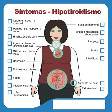 Dr Tiroides Managua Hipotiroidismo Primario