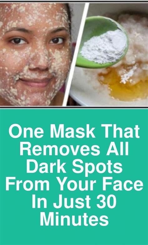 Naturally Remove Brown Spots On Face How To Get Rid Of Them Naturally