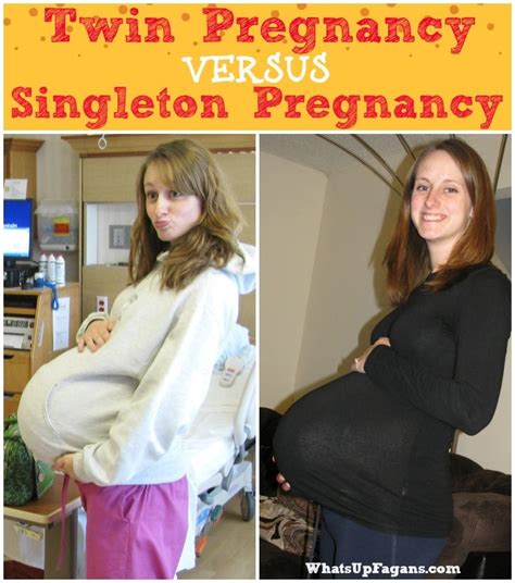 Pin On Whats Up Fagans Pregnancy And Birth