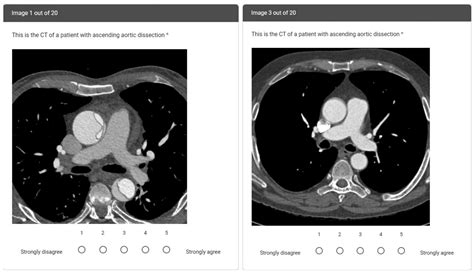 Tomography Free Full Text Comparing The Diagnostic Performance Of