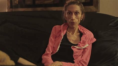 Rachael Farrokh La Mujer Con Anorexia Extrema Que Pide Ayuda En Internet