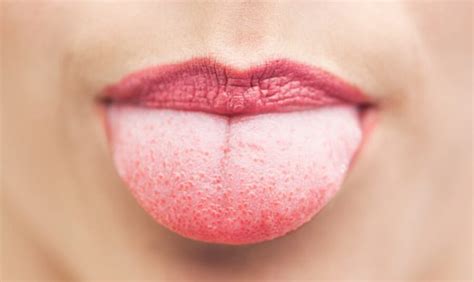 10 Warning Signs Your Tongue May Be Sending You About Your Health