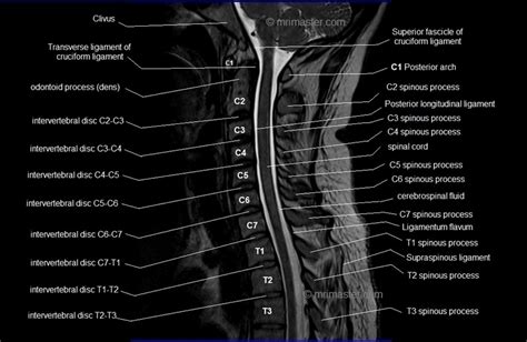 C Spine Anatomy MRI Cervical Spine Sagittal Anatomy