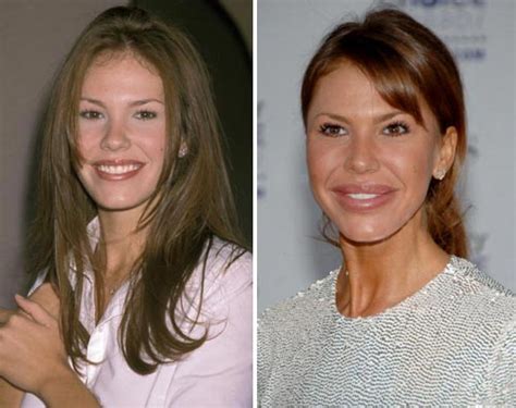 21 Celebrities With Botched Plastic Surgery Eww Gallery Ebaums World