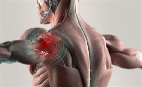 Causes Of Shoulder Pain Ways Of Managing It