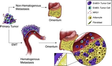 Hematogenous Metastasis Of Ovarian Cancer Rethinking Mode Of Spread