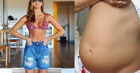 This Model Got Real About Ibs And How Shes Managing It