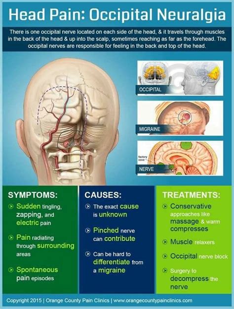 Pin On Migraine And Pain