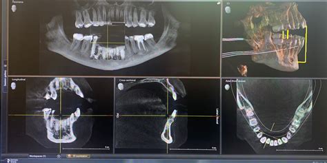 Dental Imaging 3d X Rays Dentist Pro Spa
