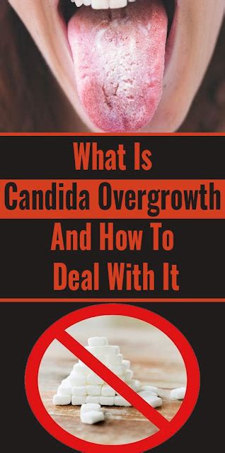 What Is Candida Overgrowth And How To Deal With It Wellness Click