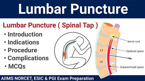 Lumbar Puncture Spinal Tap Procedure And Mcqs Youtube