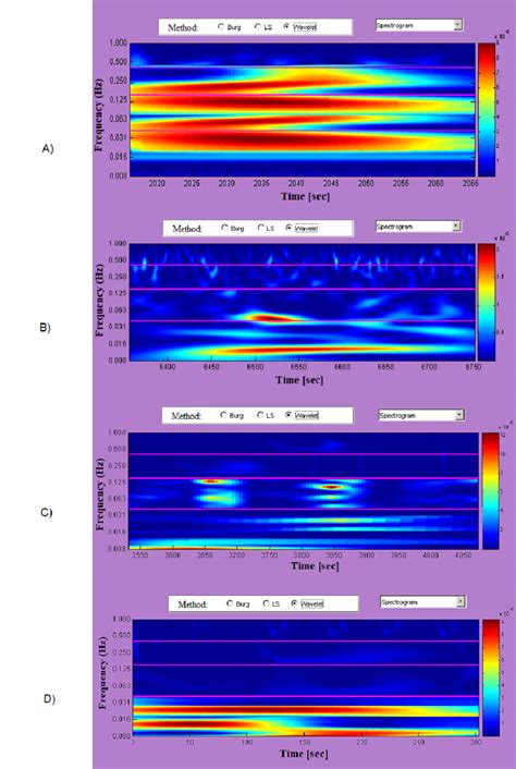 Time Frequency Spectrograms А Healthy Subject B Patient With